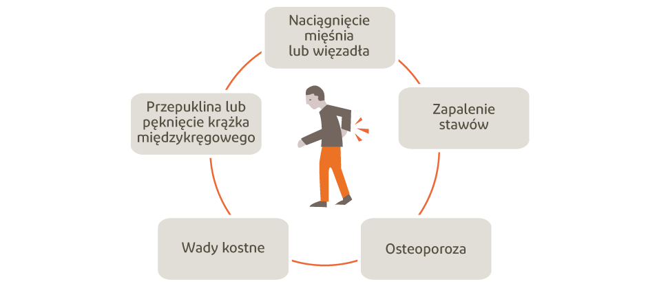 Grafika przedstawiająca potencjalne przyczyny bólu pleców