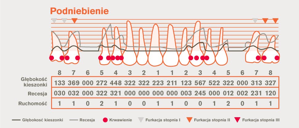 Szczegółowy schemat periodontologiczny