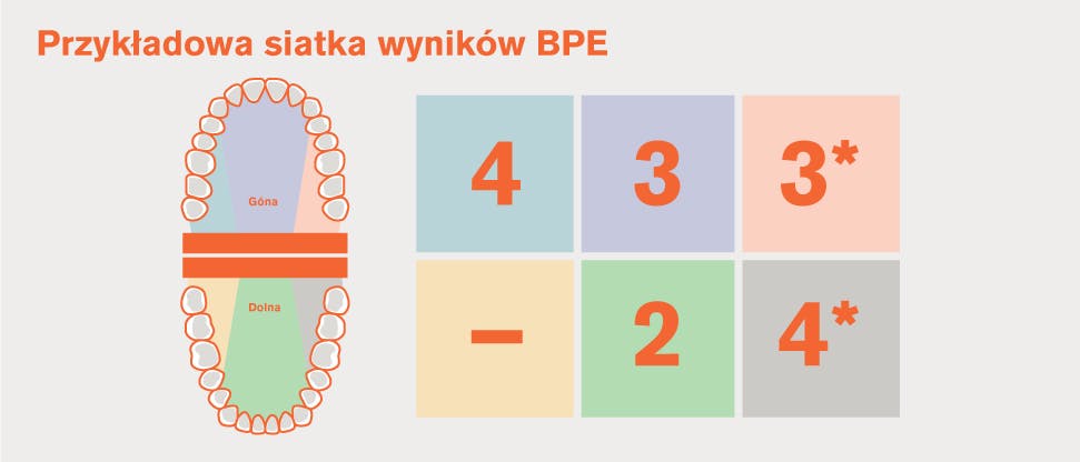 Podział uzębienia na sekstanty wg BPE i przykładowa siatka