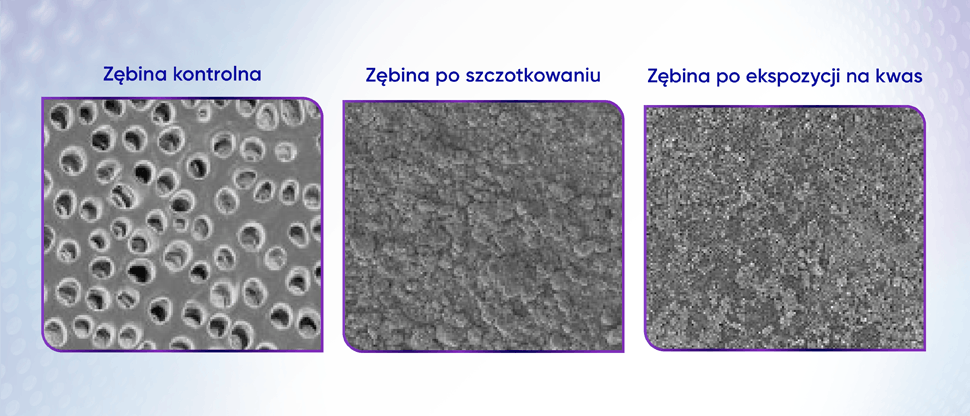 Zdjęcia powierzchni zębiny ze skaningowego mikroskopu elektronowego (SEM), na których widać warstwę ochronną powstałą po szczotkowaniu, zachowaną po ekspozycji na kwas