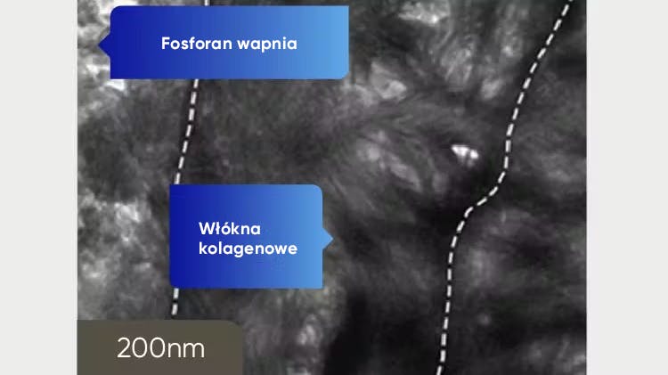 Obraz zębiny z TEM z rozdzielczością 200 nm