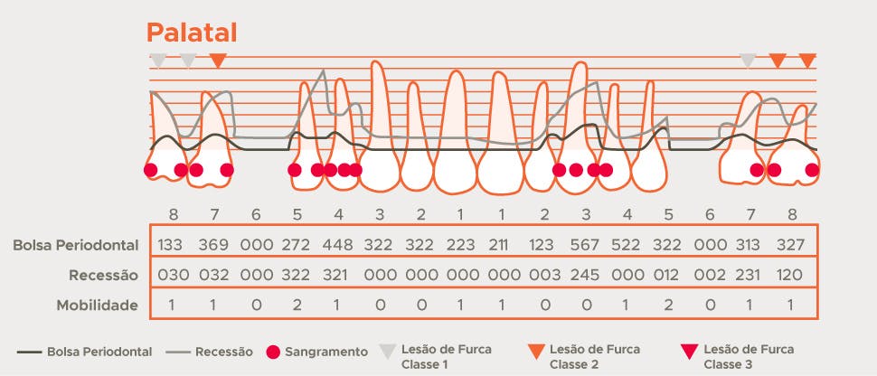Gráfico de detalhamento periodontal