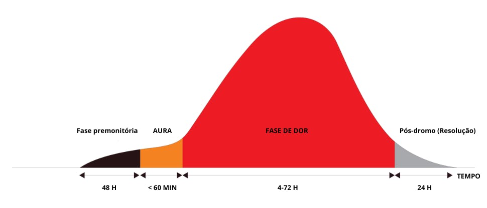 As quatro fases da enxaqueca