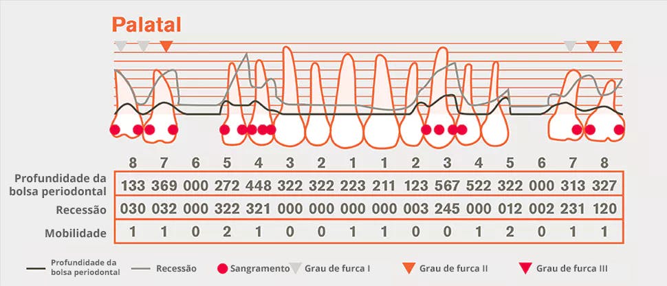 Gráfico de detalhe periodontal