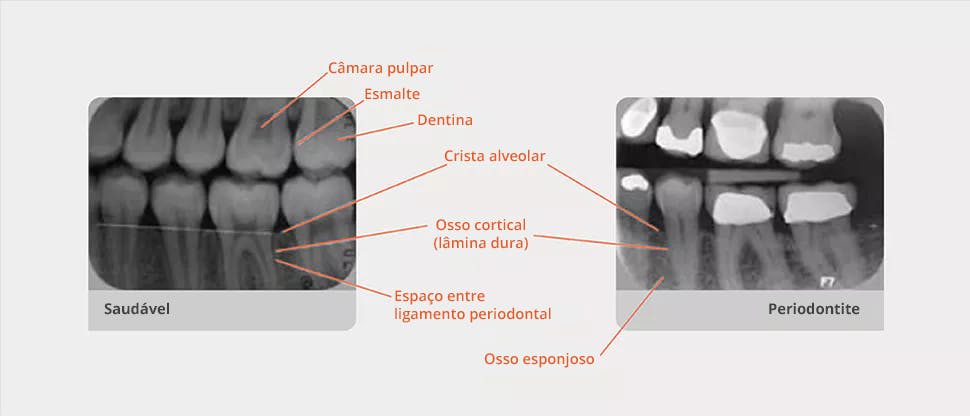 Radiografica anotada