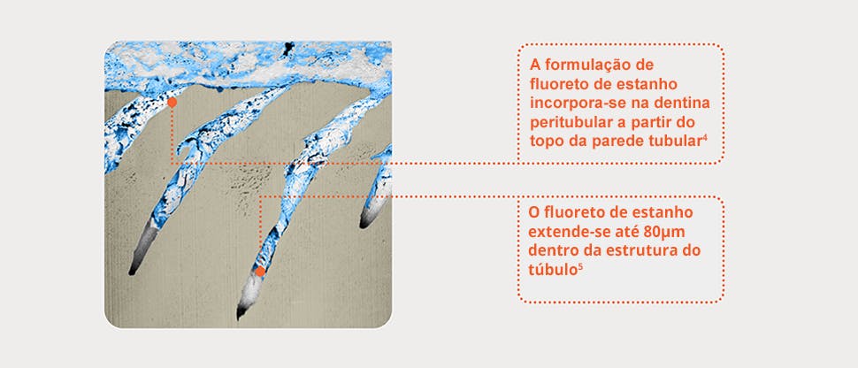 Imagem FIB-SEM representativa dos túbulos dentinários