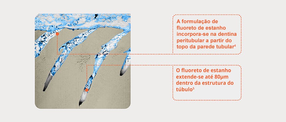 Imagem FIB-SEM representativa dos túbulos dentinários 