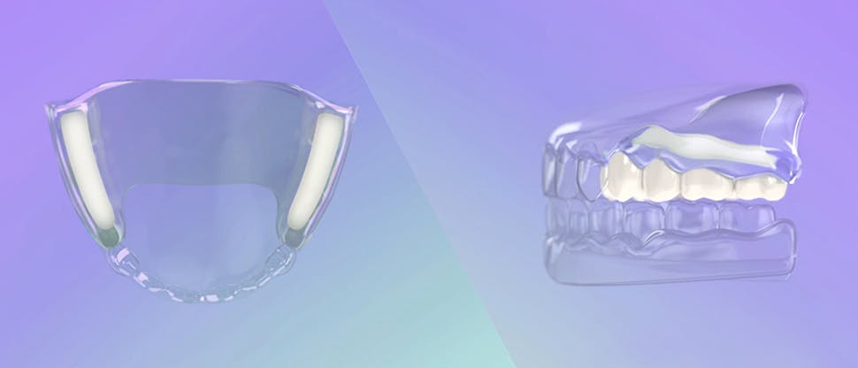 Modul de acţiune al cremei adezive pentru proteze dentare
