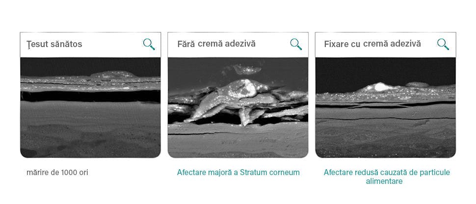 Test de laborator: afectarea mucoasei bucale după 12 ore de interacţiune cu seminţe de mac