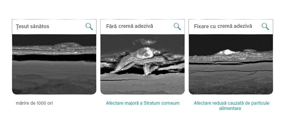 Test de laborator: afectarea  mucoasei bucale după 12 ore de interacţiune cu seminţe de mac