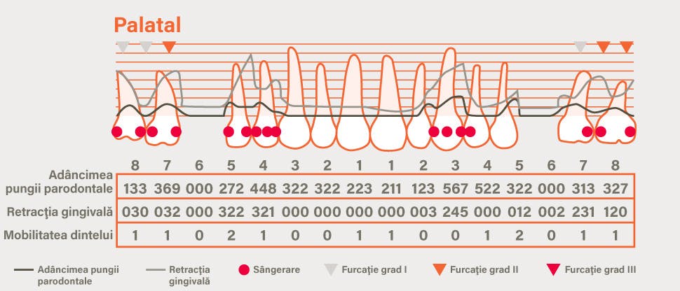 Grafic detaliat parodontal