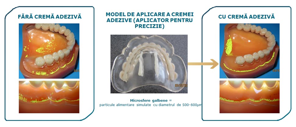 Eficienta cremelor adezive Corega