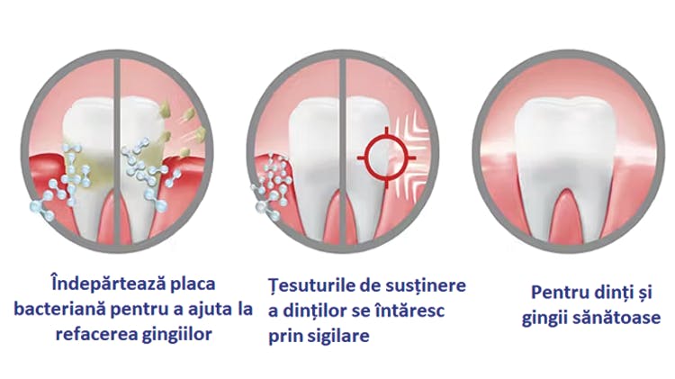 Cu ce ajută pasta de dinți dinții pacienților