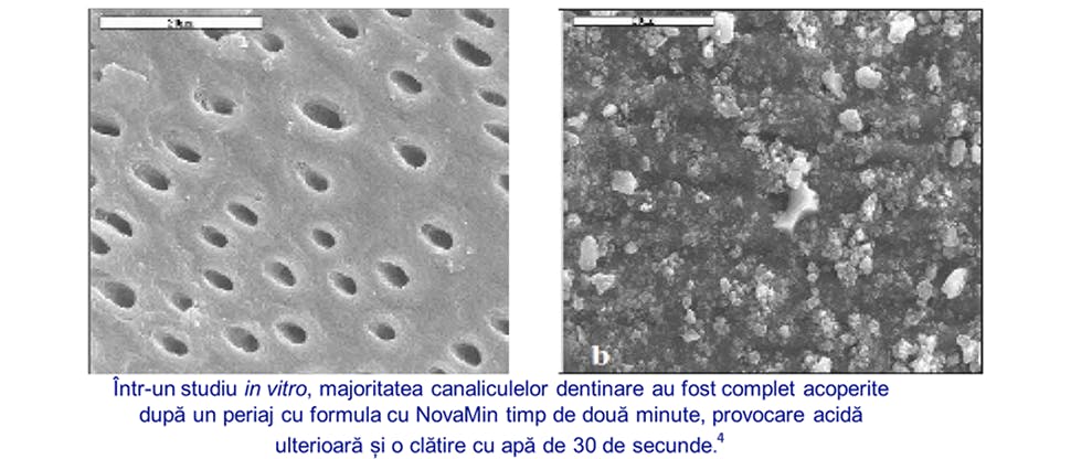 Studiu in vitro