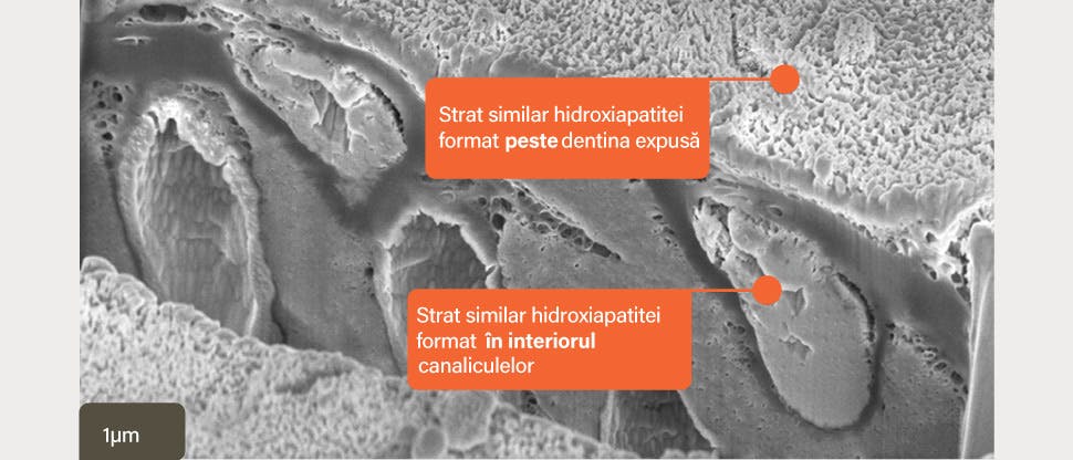 Imagine SEM a stratului similar hidroxiapatitei