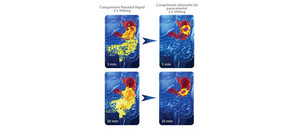 Imagini ce ilustrează dezintegrarea rapidă în stomac a comprimatelor de Panadol Rapid comparativ cu comprimatele obișnuite de paracetamol.