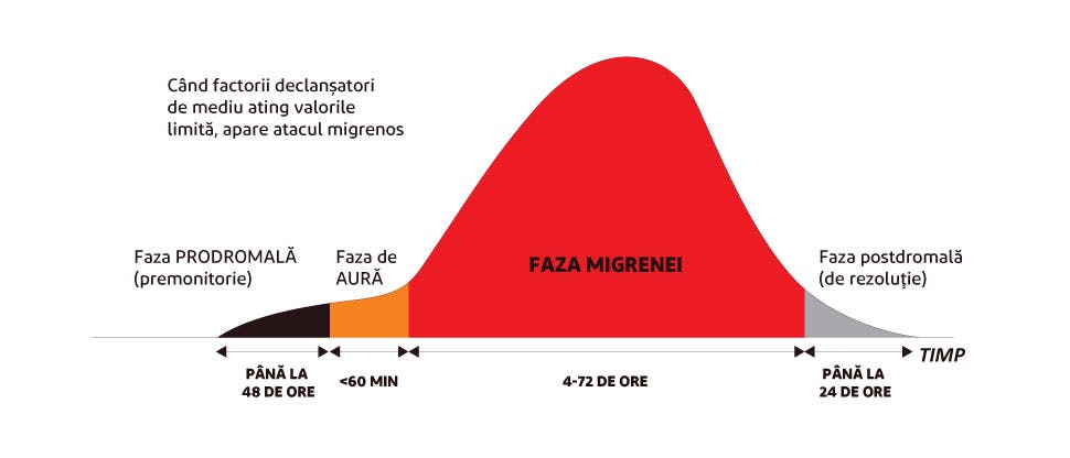 Cele patru faze ale migrenei