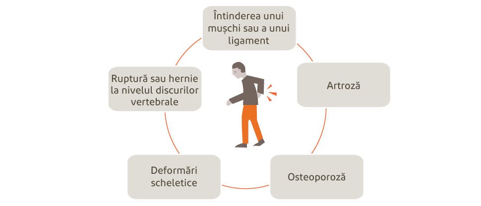 Grafic care ilustrează posibile cauze ale durerii de spate