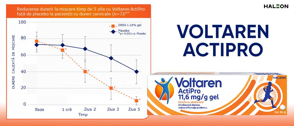 Grafic reducerea mișcării