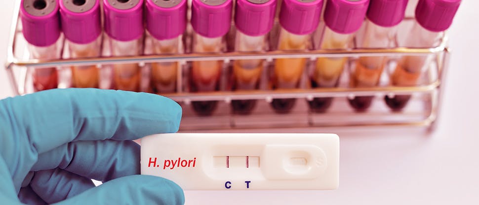 hold-rapid-test-cassette-which-show-helicobacter-pylori-igg-h-pylori-positive-result