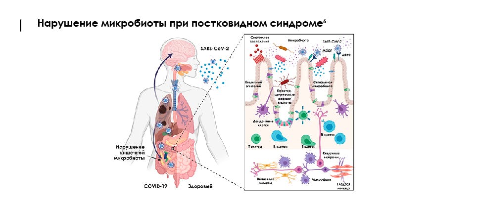 После ковида болит кишечник что делать