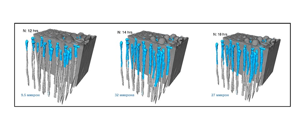 Средняя глубина окклюзии в образцах дентина, обработанных зубной пастой Sensodyne Восстановление и Защита. Глубокое восстановление