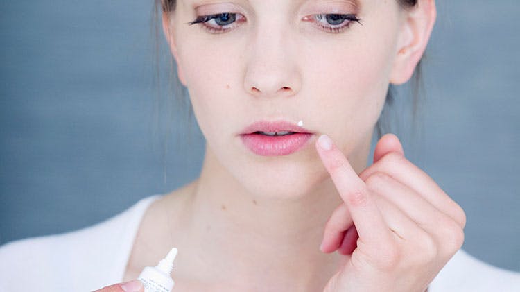 Женщина, наносящая на губы крем для лечения герпеса губ