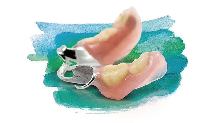 Zubné náhrady