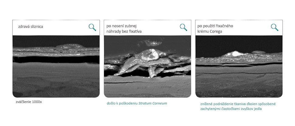 Sliznica ústnej dutiny po 12 hodinách od podráždenia makom a akrylátovými diskami v laboratórnych testoch