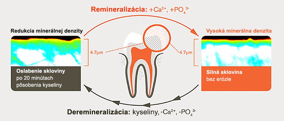 Proces demineralizácie a remineralizácie po 20 minútach pôsobenia kyselín