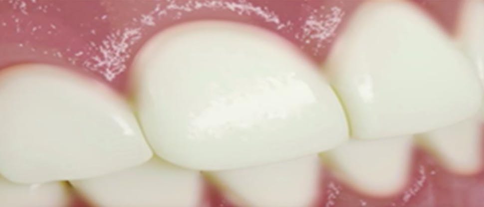 Video mechanizmu pôsobenia zubnej pasty Pronamel