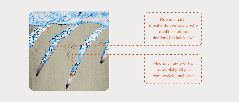 Reprezentatívny snímok dentínových kanálikov pomocou dvojzväzkového mikroskopu