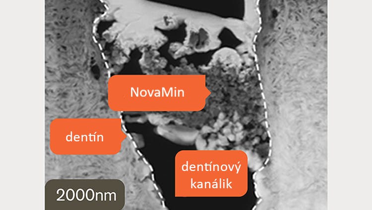 TEM snímok dentínu s rozlíšením 2000 nm
