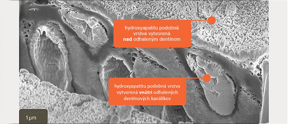 Snímok SEM priečneho rezu in vitro