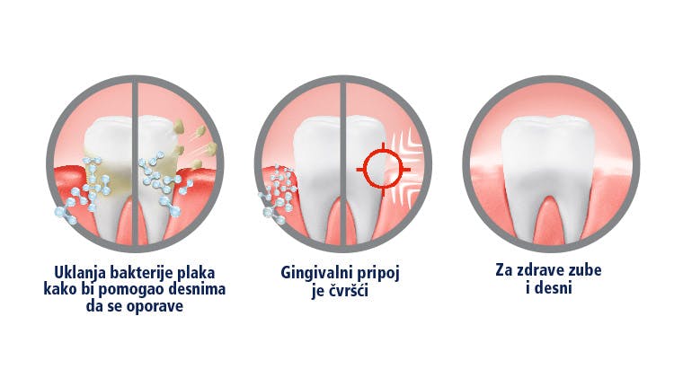 Grafika koja prikazuje kako parodontax Active Gum Repair uklanja bakterije plaka, zateže desni i pomaže u zdravlju zuba i desni