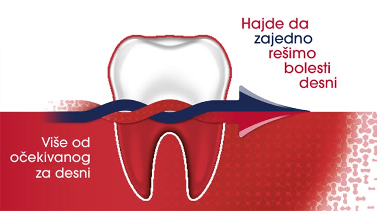 parodontax fluoride pasta za zube pomaže u prevenciji i lečenju krvarenja desni i pomaže sa gingivitisom