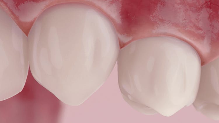 Slika zdravih zuba i desni