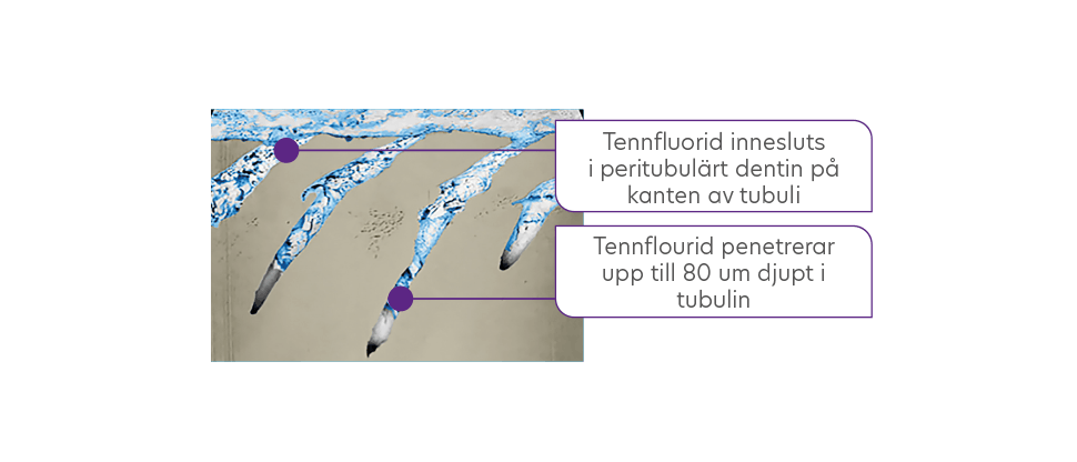 FIB-SEM bild av dentala tubuli