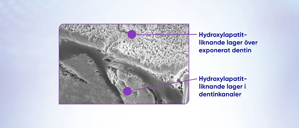 Bilden visar SEM-bild på hydroxyapatit-liknande lager över exponerat dentin