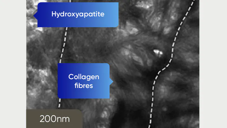 TEM-bild av dentin vid 200 nm