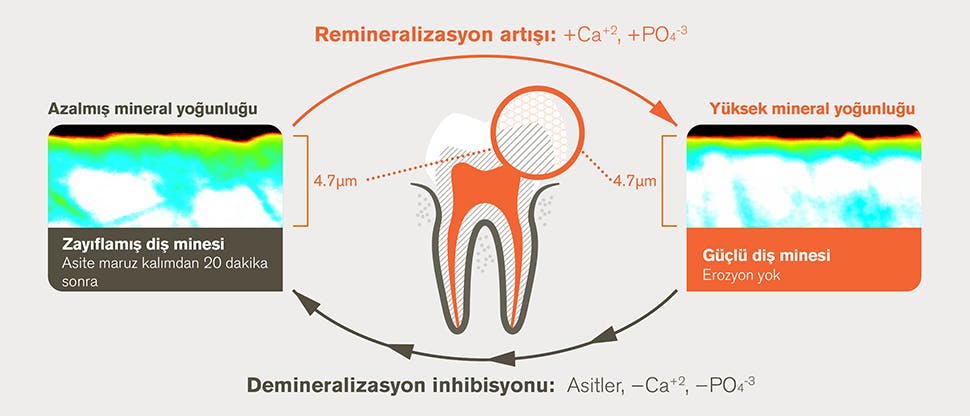 20 dakika aside maruz bırakışmadan sonra demineralizasyon ve remineralizasyon süreci