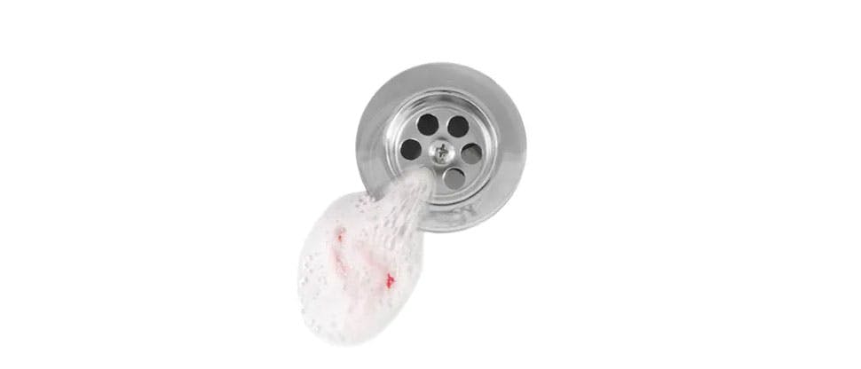 Kan görülen lavabo deliği