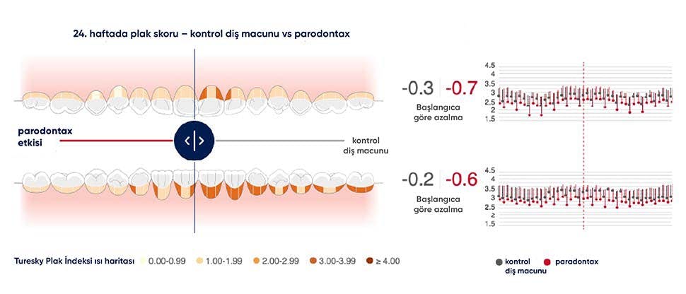 Paradontax sodyum bikarbonatlı diş macunu kullanıldıktan sonra plağın azaldığını gösteren ağız haritası aracının görüntüsü