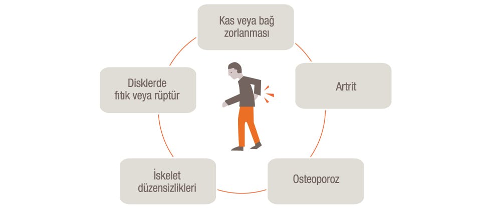 Bel ve sırt ağrılarının potansiyel nedenlerini gösteren grafik