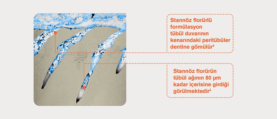 Dentin tübüllerinin temsili FIB-SEM görüntüsü