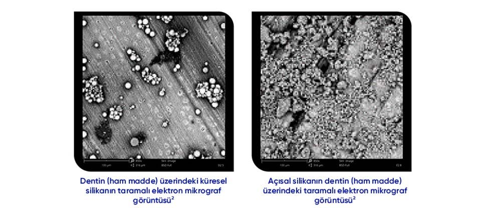 Küresel ve açısal temizleme parçacıklarının taramalı elektron mikrograf görüntüsü