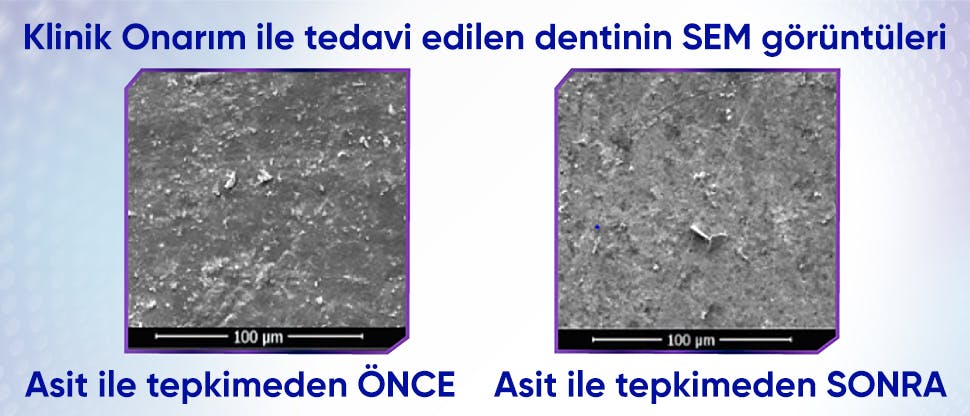 Sensodyne Klinik Onarım Diş Macunu ile tedavi edilen dentinin, asit zorluğu öncesi ve sonrası direnç göstermesini gösteren görüntüler.
