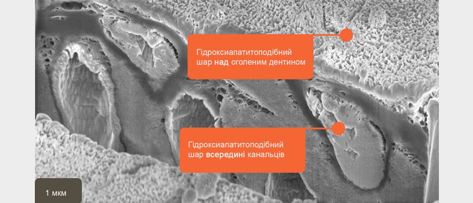 РЕМ зображення гідроксиапатитоподібного шару