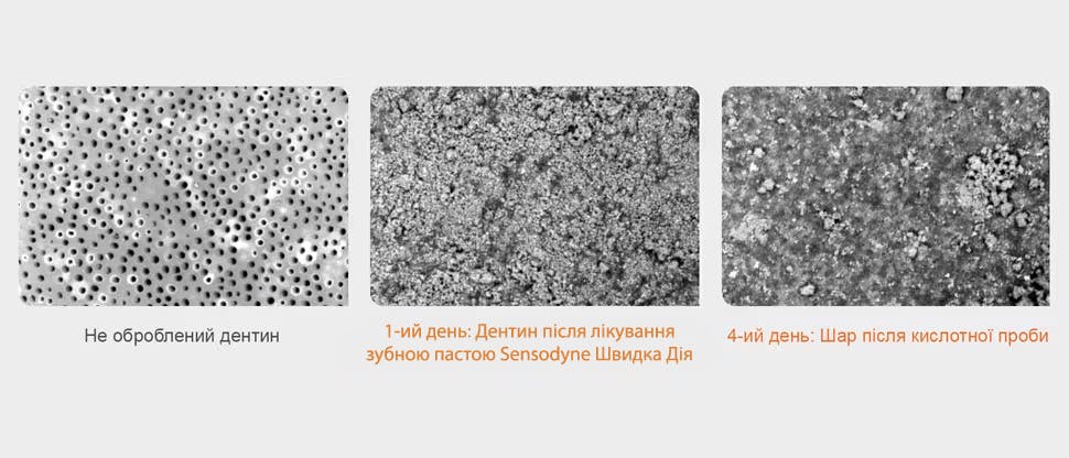 РЕМ зображення дентину