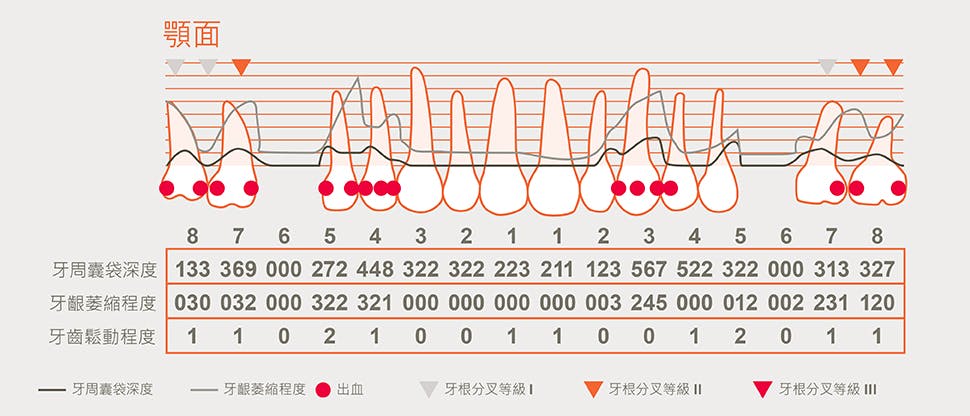 詳細的牙周病檢查紀錄表